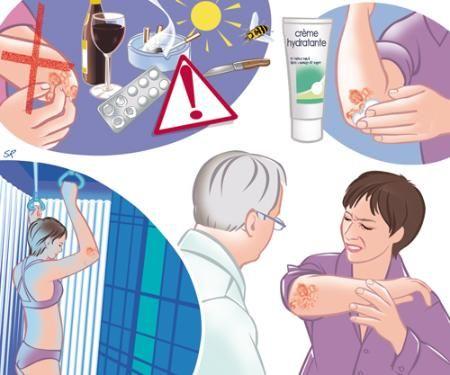 Achten Sie auf Ihre Haut, vermeiden sie Umweltfaktoren, die dafür bekannt sind, dass sie Schuppenflechte auslösen, und sprechen Sie mit Ihrem Arzt, wenn die Schuppenflechte Auswirkungen auf Ihr Alltagsleben hat.